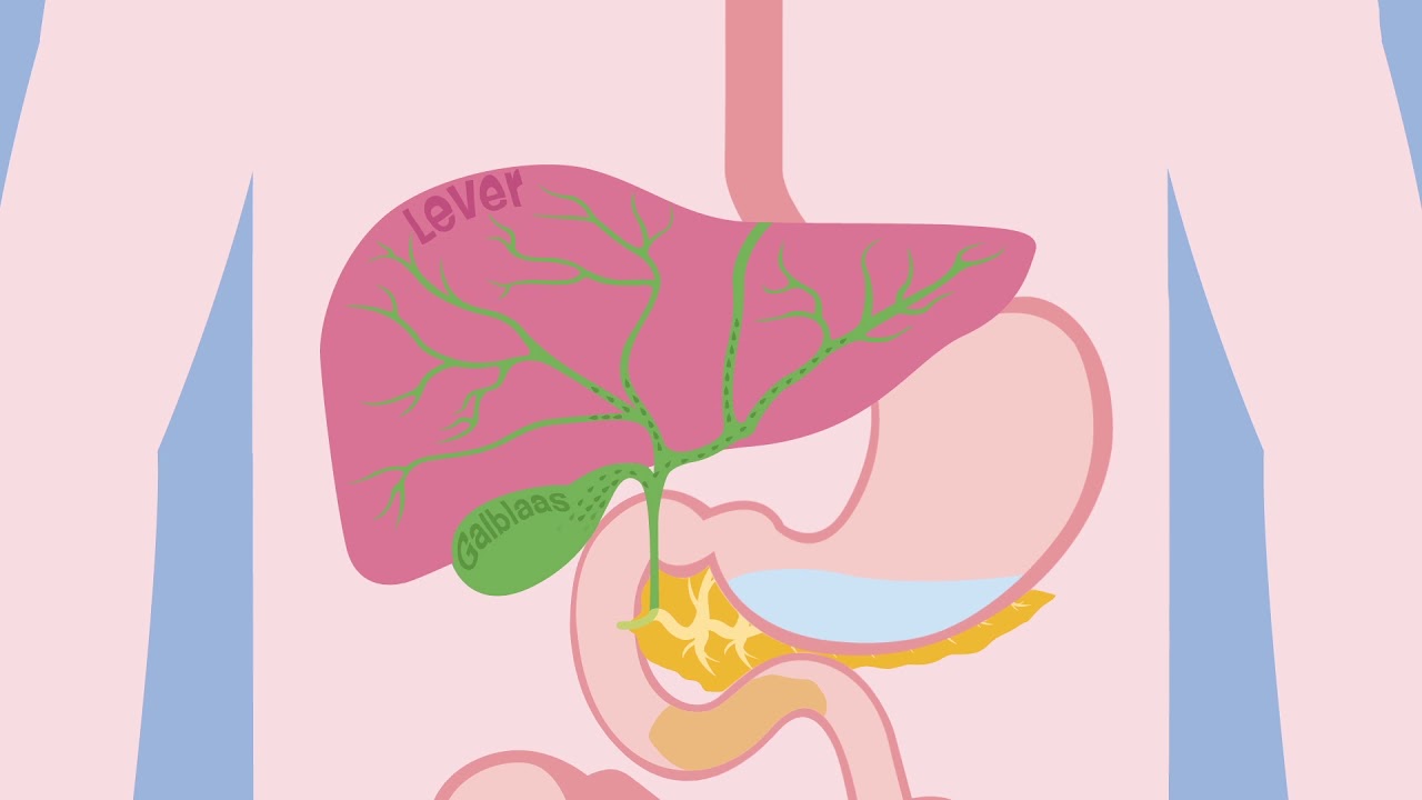 Duodenitis, ontstoken twaalfvingerige darm