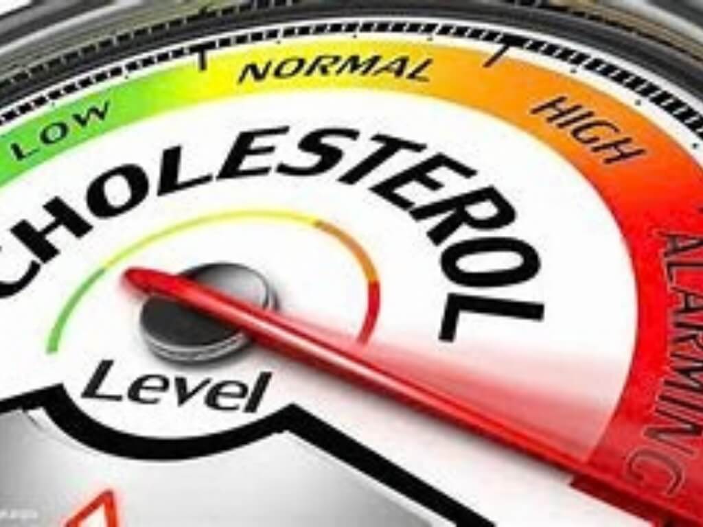 Beleid en preventie bij hoog cholesterolgehalte